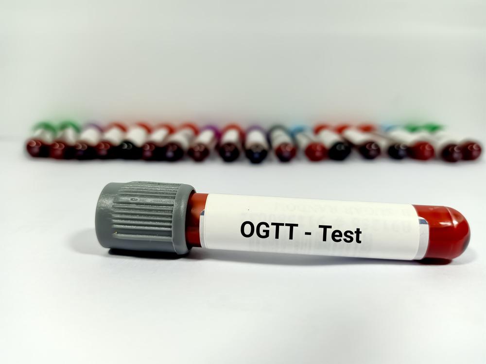Diagnose diabetes mellitus with Oral Glucose Tolerance Test
