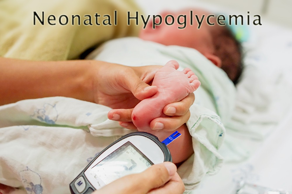 neonatal hypoglycemia