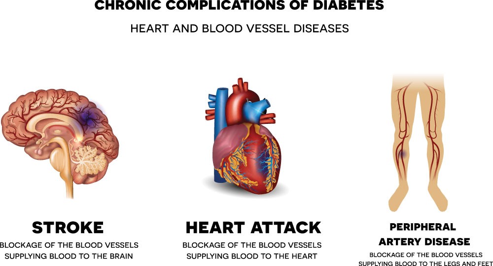 diabetes heart disease