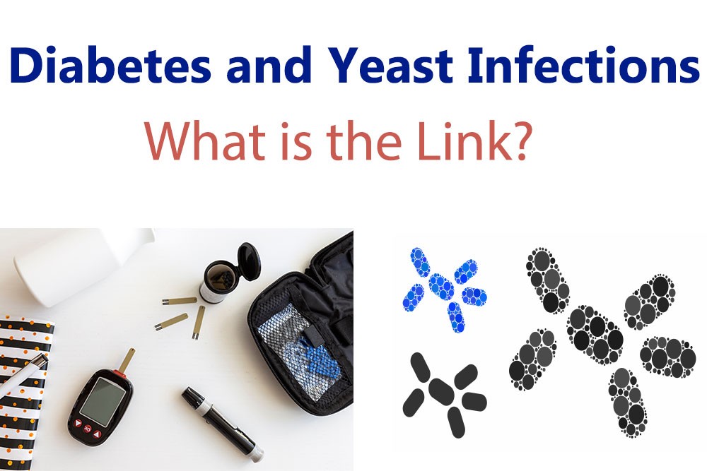 Diabetes and Yeast Infections: How Can Diabetic Patients Get Rid of Yeast Infections?
