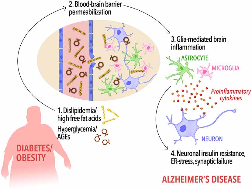 Diabetes and Alzheimer’s – Know The Association Between Type 2 Diabetes and Alzheimer’s