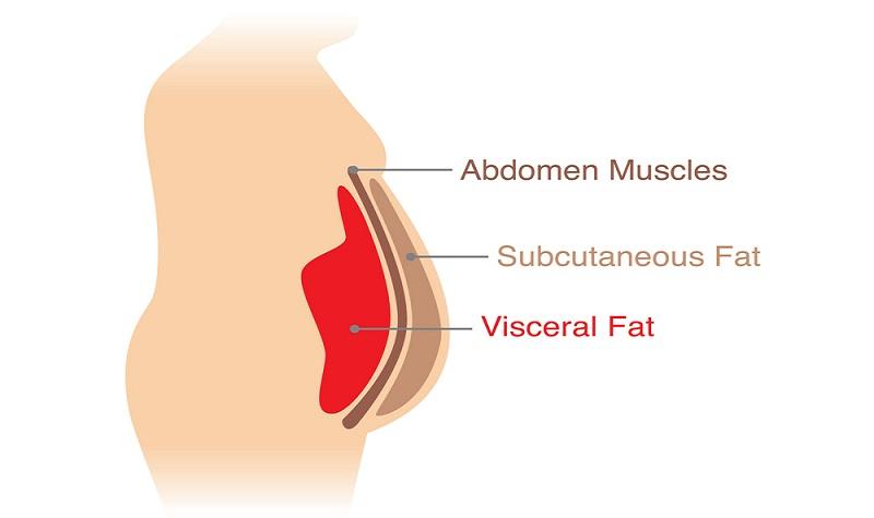 What is Visceral Fat and How to Get Rid of it?