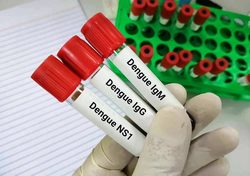 dengue diagnosis