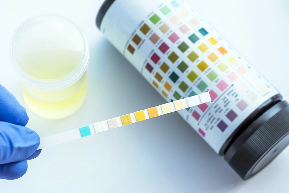 urine sugar test